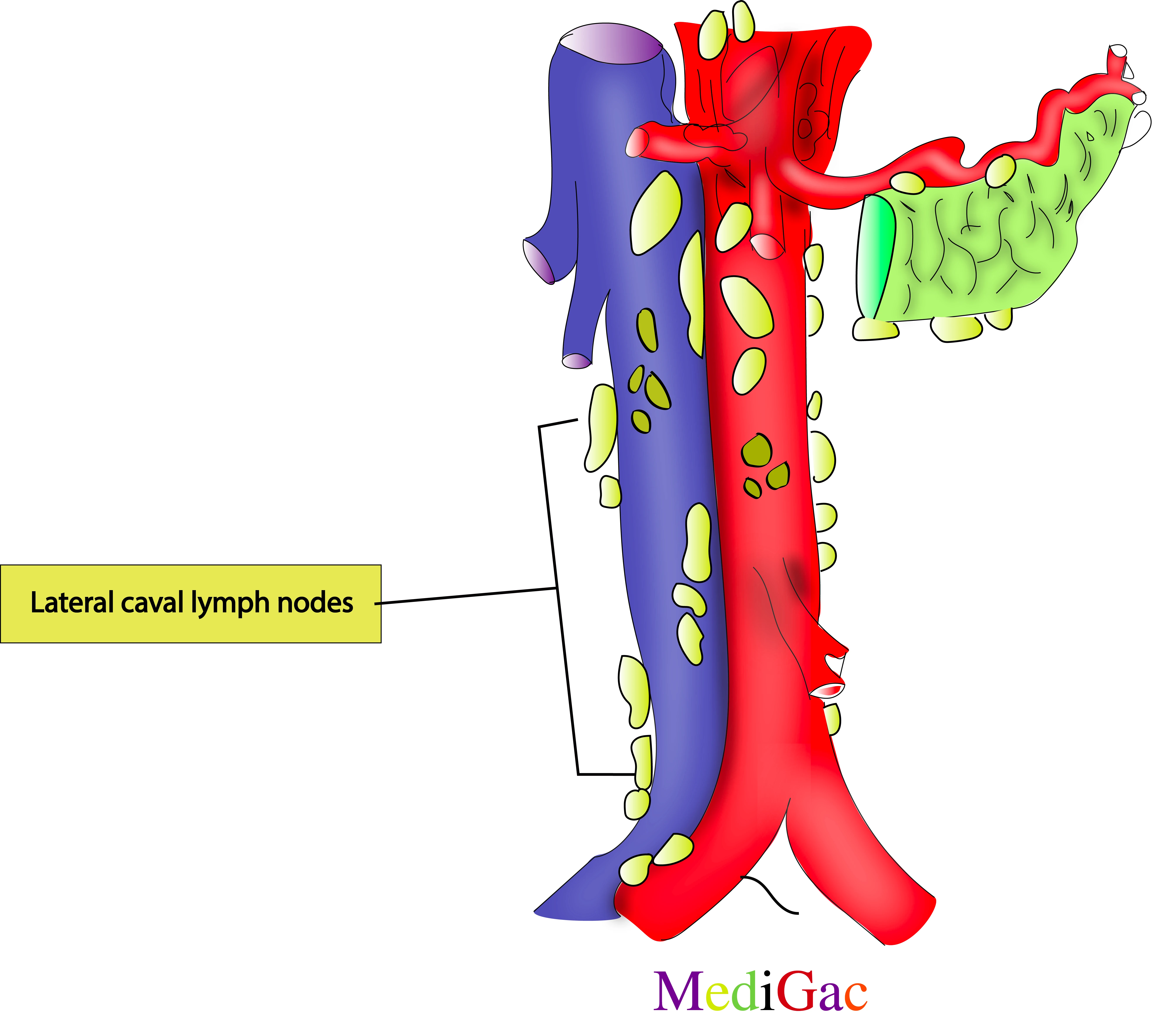 Lateral caval lymph nodes